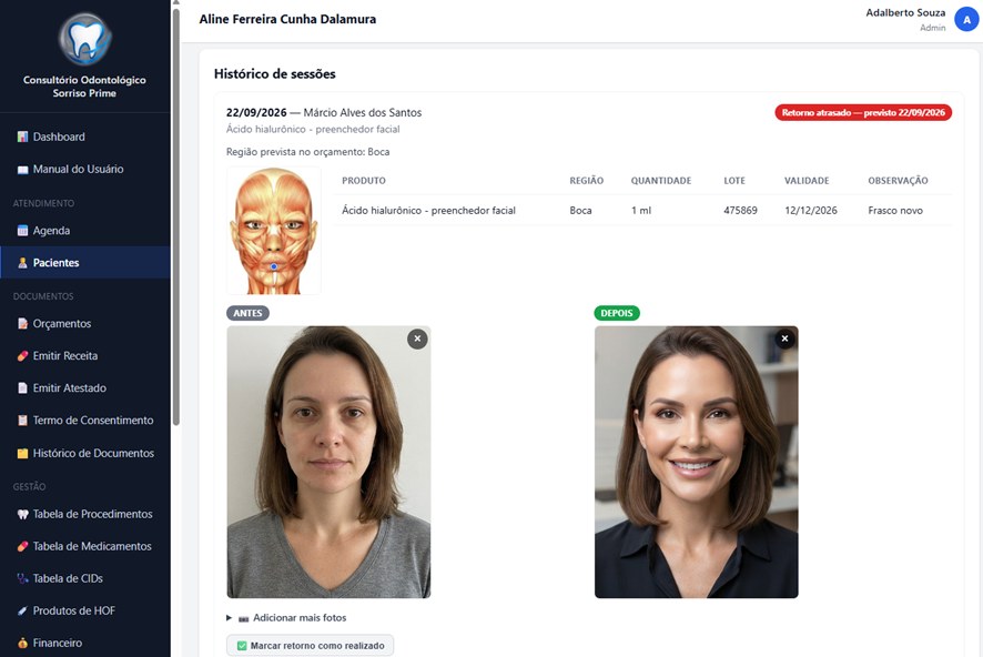 Histórico de sessões de Harmonização Orofacial com fotos de antes e depois